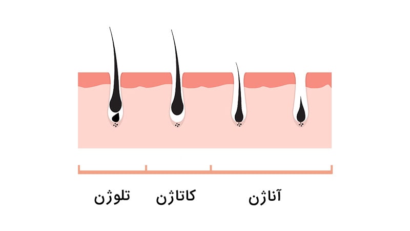 رشد تارهای مویی به چه صورت می باشد